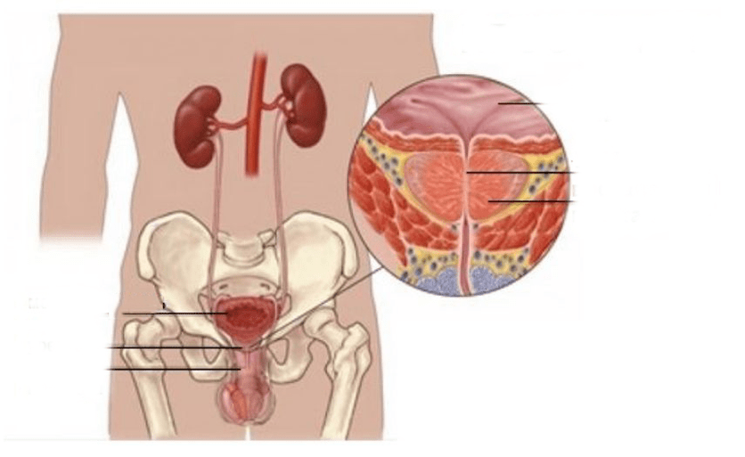 Prostatite negli uomini