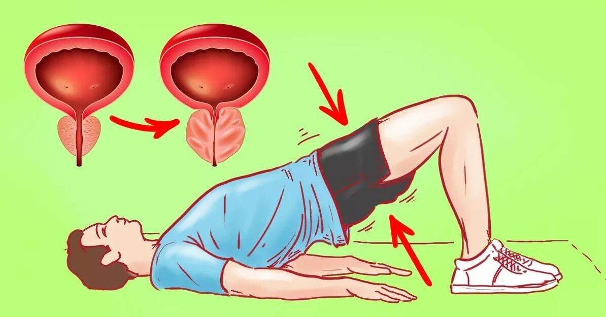 Esercizi contro la prostatite