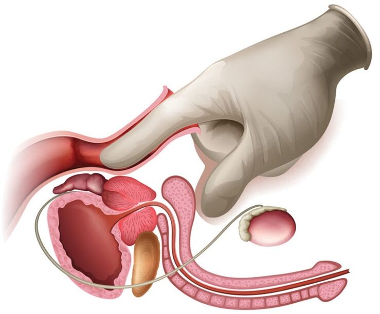 Massaggio alla prostata
